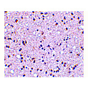 TMP21 Antibody 100µg