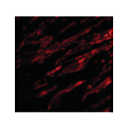VISA Antibody internal 100µg