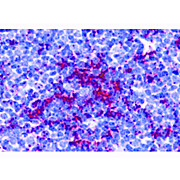 TLR8 Antibody nterm 100µg