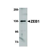 Anti-ZEB1 (RABBIT) Antibody, 100µg, Liquid (sterile filtered)
