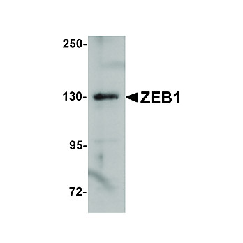 Anti-ZEB1 (RABBIT) Antibody, 100µg, Liquid (sterile filtered)