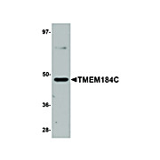 Anti-TMEM184C (RABBIT) Antibody, 100µg, Liquid (sterile filtered)