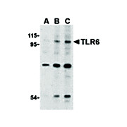 TLR6 Antibody nterm 100µg