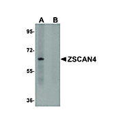 Anti-ZSCAN4 (RABBIT) Antibody, 100µg, Liquid (sterile filtered)