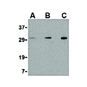 TIGAR Antibody 100µg