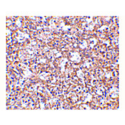 TEM4 Antibody 100µg