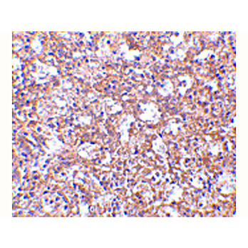 TEM4 Antibody 100µg