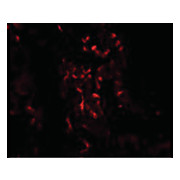 TNFAIP3 Antibody internal 100µg