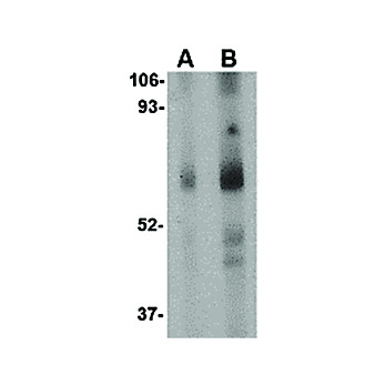 STEAP1 Antibody internal 100µg