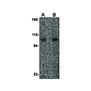 VPS53 Antibody internal 100µg