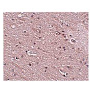 Anti-TMEM16B (RABBIT) Antibody, 100µg, Liquid (sterile filtered)
