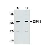 Anti-ZIP11 (RABBIT) Antibody, 100µg, Liquid (sterile filtered)
