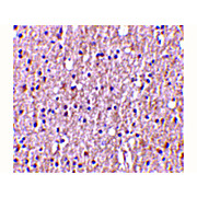 Anti-TWEAK (RABBIT) Antibody, 100µg, Liquid (sterile filtered)