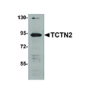 Anti-TCTN2 (RABBIT) Antibody, 100µg, Liquid (sterile filtered)