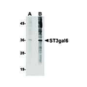Anti-ST3gal6 (RABBIT) Antibody, 100µg, Liquid (sterile filtered)