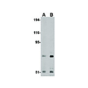 TNPO3 Antibody nterm 100µg