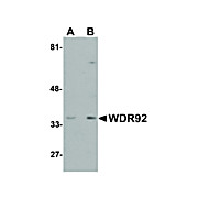 Anti-WDR92 (RABBIT) Antibody, 100µg, Liquid (sterile filtered)