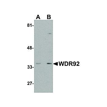 Anti-WDR92 (RABBIT) Antibody, 100µg, Liquid (sterile filtered)