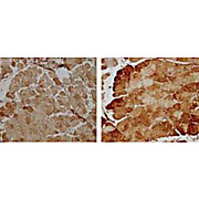 Mn SOD Antibody hu 100µg