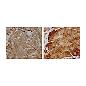 Mn SOD Antibody hu 100µg