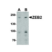 Anti-ZEB2 (RABBIT) Antibody, 100µg, Liquid (sterile filtered)