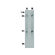 ZIP10 Antibody internal-17 100µg