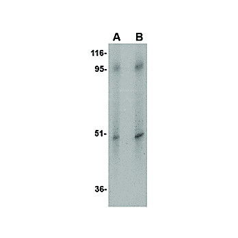 ZIP10 Antibody internal-17 100µg