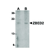 Anti-ZBED2 (RABBIT) Antibody, 100µg, Liquid (sterile filtered)
