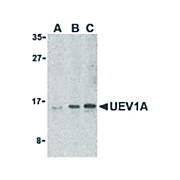 Anti-UEV1A (RABBIT) Antibody, 100µg, Liquid (sterile filtered)