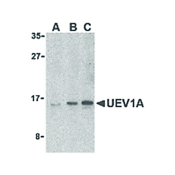 Anti-UEV1A (RABBIT) Antibody, 100µg, Liquid (sterile filtered)