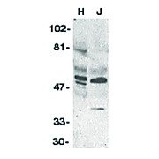 Anti-ZIPK (RABBIT) Antibody, 100µg, Liquid (sterile filtered)