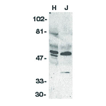 Anti-ZIPK (RABBIT) Antibody, 100µg, Liquid (sterile filtered)
