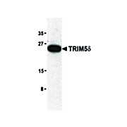 Anti-TRIM5 delta (RABBIT) Antibody, 100µg, Liquid (sterile filtered)
