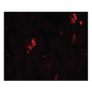 Rb Anti-SUMO2/3 Antibody 100µg