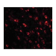 Anti-TTBK1 (RABBIT) Antibody, 100µg, Liquid (sterile filtered)