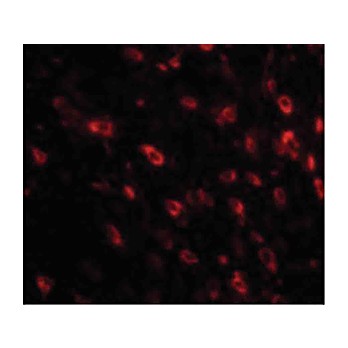 Anti-TTBK1 (RABBIT) Antibody, 100µg, Liquid (sterile filtered)