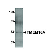 Anti-TMEM16A (RABBIT) Antibody, 100µg, Liquid (sterile filtered)