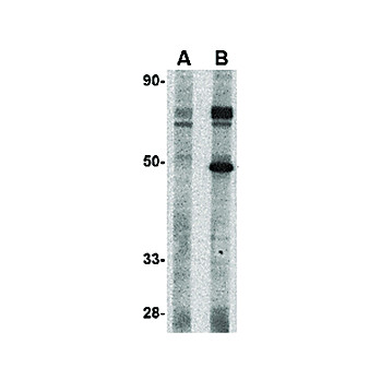 Tslp Receptor Antibody 100µg