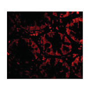 STEAP2 Antibody 100µg