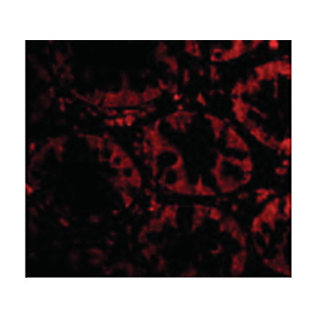 STEAP2 Antibody 100µg