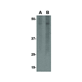 Anti-Spred3 (RABBIT) Antibody, 100µg, Liquid (sterile filtered)