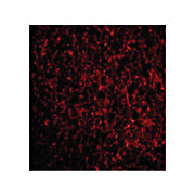 TMP21 Antibody 100µg