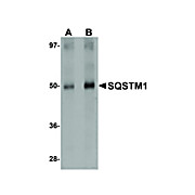 Anti-SQSTM1 (RABBIT) Antibody, 100µg, Liquid (sterile filtered)