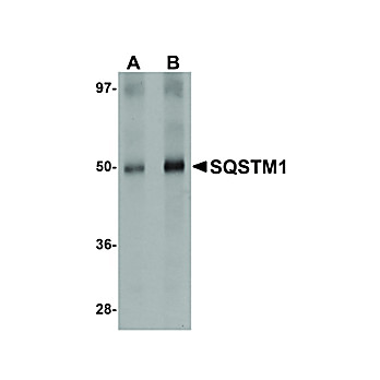 Anti-SQSTM1 (RABBIT) Antibody, 100µg, Liquid (sterile filtered)