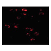 Anti-TMEM18 (RABBIT) Antibody, 100µg, Liquid (sterile filtered)