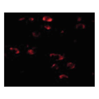 Anti-TMEM18 (RABBIT) Antibody, 100µg, Liquid (sterile filtered)