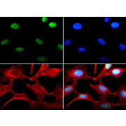 Anti-Histone H3 [Monomethyl Lys4] (RABBIT) Antibody, 50µg, Liquid (sterile filtered)