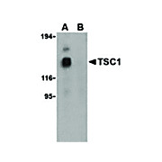 TSC1 Antibody internal 100µg