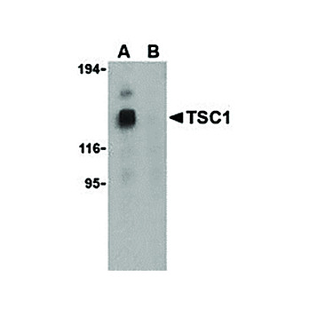 TSC1 Antibody internal 100µg