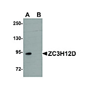 Anti-ZC3H12D (RABBIT) Antibody, 100µg, Liquid (sterile filtered)